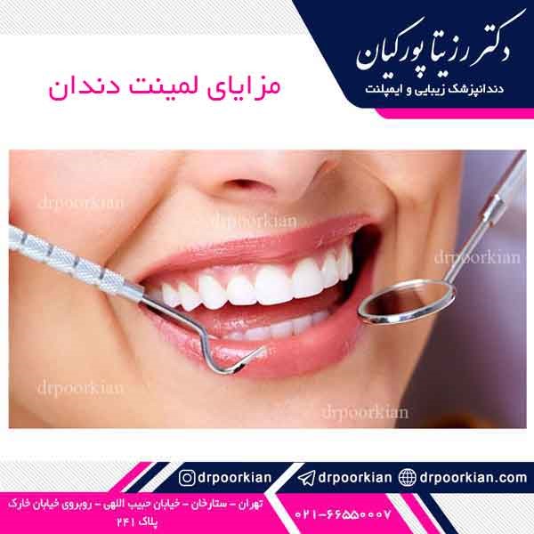 عکس لمینت دندان
