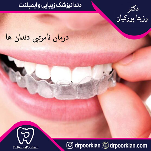 عکس اصلاح نامرتبی دندان ها