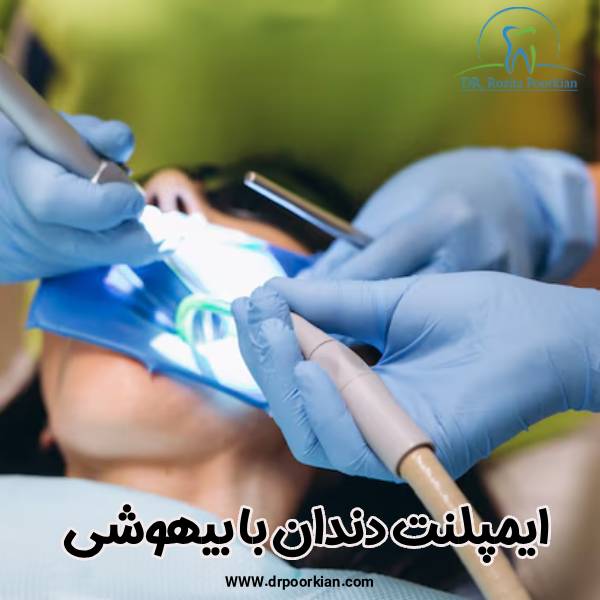 ایمپلنت دندان بدون بیهوشی - دکتر رزیتا پورکیان