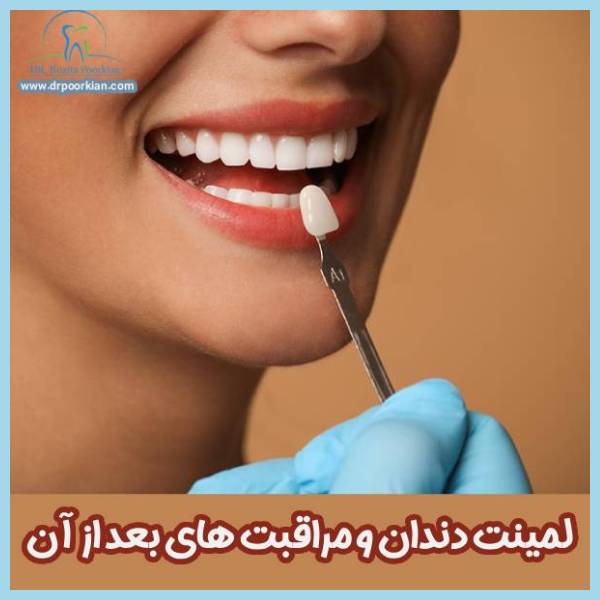 مراقبت های بعد از لیمنت دندان - دکتر رزیتا پورکیان